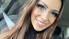 Alex Sandroski má um�lý chrup.