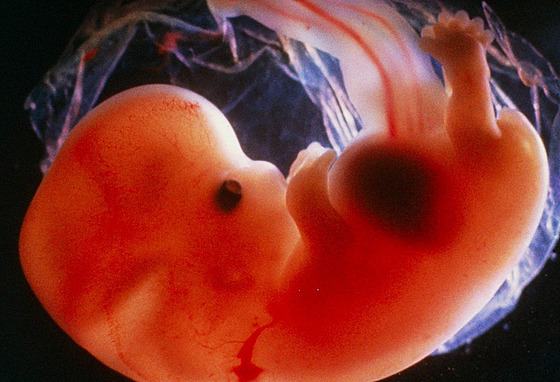 ilustra�ní snímek