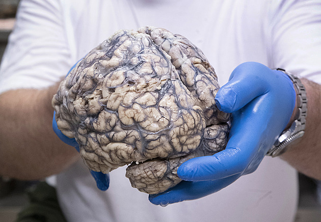 V zaízení Brain Bank se pipravují a uchovávají vzorky lidské tkán, hlavn...