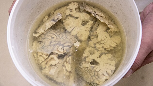 V mozkov� bance ve Fakultn� Thomayerov� nemocnici se uchov�vaj� a zkoumaj�...