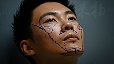 Sia �u-�ung ve svých 27letech podstoupil u� n�kolik plastických operací. (22....