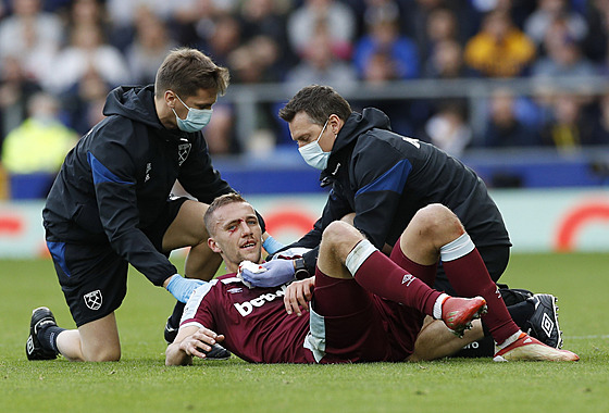 Zkrvavený Tomá Souek v utkání proti Evertonu.