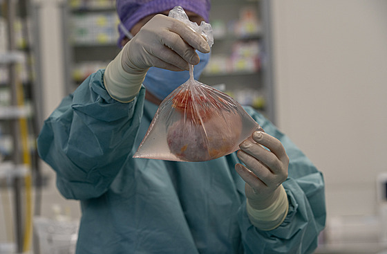 Lékaři pražského IKEM transplantují jednomu z pacientů ledvinu, která...