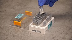 Odebrané vzorky urené pro testování PCR metodou