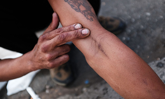 Fentanyl je zbraň hromadného ničení. Trump přitvrzuje v protidrogovém tažení