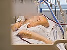 Covidov� pacient p�ipojen� na p��stroj ECMO, mimot�ln� podporu srde�n� a...