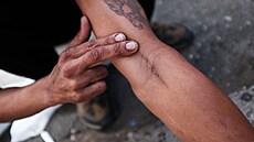 Bronx pat�í mezi nejvíce drogami zamo�ené �tvrti New Yorku. V roce 2016 tam na...