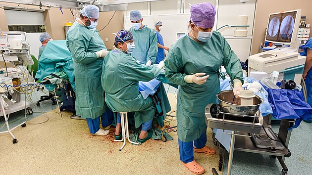 Lkai v Baov nemocnici ve Zln penesli st ltkov kosti do rozdrcenho brce pacientce, kter mla nehodu v Buchlovskch horch. (leden 2022)