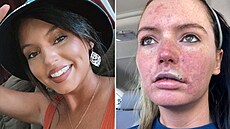 Výpl� rt� �enu zohyzdila.