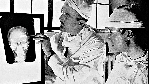 Portugalský neurolog António Egas Moniz dostal v roce 1949 Nobelovu cenu za...