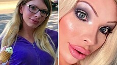 Serena se do plastika zamilovala.