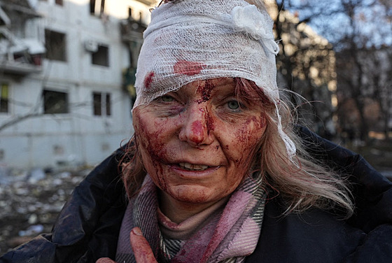 Tvá Oleny Kurylové se stala symbolem brutality ruské invaze na Ukrajinu. (24....