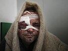 41letý Serhij Kralja po operaci v nemocnici v Mariupolu (11. bezna 2022)