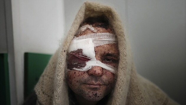 41letý Serhij Kralja po operaci v nemocnici v Mariupolu (11. března 2022)