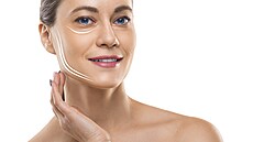 Ilustra�ní snímek