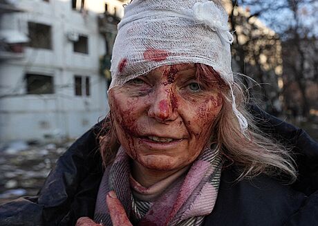 Tvá Oleny Kurylové se stala symbolem brutality ruské invaze na Ukrajinu. (24....