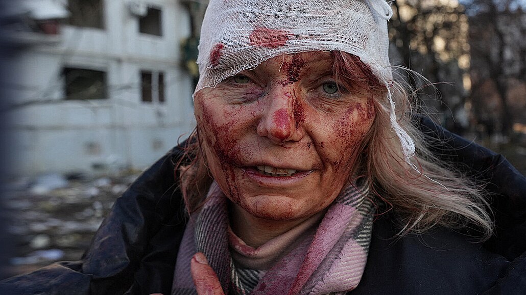 Tvář Oleny Kurylové se stala symbolem brutality ruské invaze na Ukrajinu. (24....