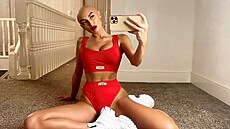 ZaraLena Jacksonová s alopecií bojuje poslední dva roky.