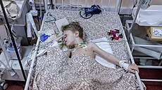 Tíletý chlapec Dima, který byl zrann pi ostelování Mariupolu, leí na lku...