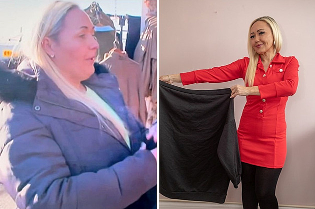 Žena se bála pobytu v nemocnici, zhubla polovinu své původní váhy