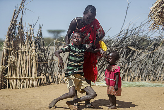V suchem postieném Somálsku, Etiopii a Keni umírá jeden lovk hlady kadých...
