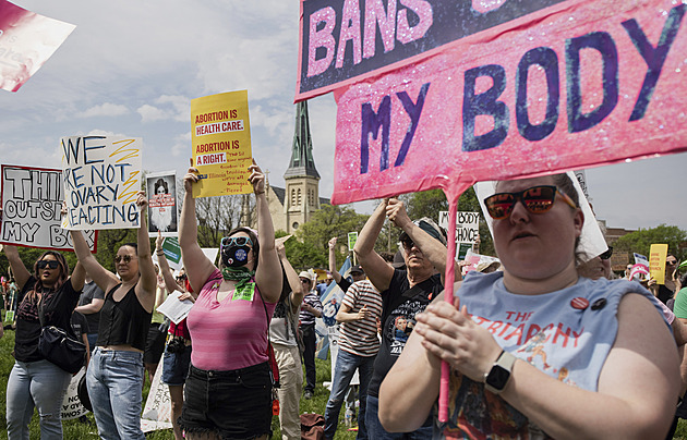 Po zákazu potratů v USA roste počet sterilizací u mužů i žen, zjistila studie