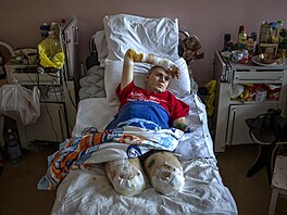 Dvaadvacetiletý Anton Gladun leí v Tetí mstské nemocnici v ukrajinských...