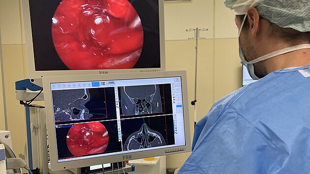 Během CT navigované operace vedlejších dutin nosních má chirurg o všem takřka dokonalý přehled.