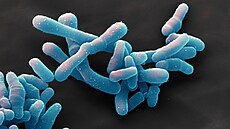 Bakterie Corynebacterium diphteriae, původce onemocnění záškrtu