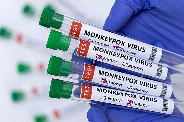 Vakcín proti opičím neštovicím není v USA dost, stát vyhlásí stav nouze
