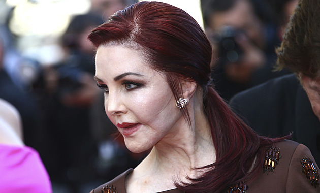 Obličej bez vrásek za cenu ztráty mimiky. Priscilla Presley nezvládá věk