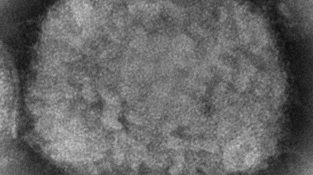 Opi netovice neboli monkeypox je virov onemocnn, kter se podob pravm netovicm, ale je mrnj. Zpsobuje ho virus rodu Orthopoxvirus z eledi Poxviridae.
