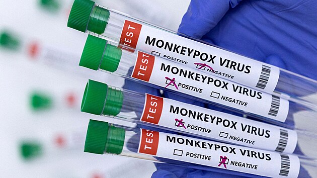 Opičí neštovice neboli monkeypox je virové onemocnění, které se podobá pravým neštovicím, ale je mírnější. Způsobuje ho virus rodu Orthopoxvirus z čeledi Poxviridae.