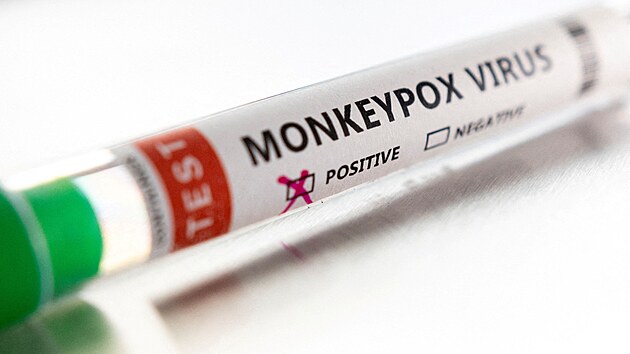 Opi netovice neboli monkeypox je virov onemocnn, kter se podob pravm netovicm, ale je mrnj. Zpsobuje ho virus rodu Orthopoxvirus z eledi Poxviridae.
