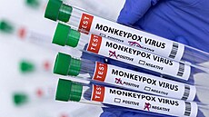 Opi�í ne�tovice neboli monkeypox je virové onemocn�ní, které se podobá pravým...
