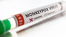 Opií netovice neboli monkeypox je virové onemocnní, které se podobá pravým...