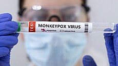 Opií netovice neboli monkeypox je virové onemocnní, které se podobá pravým...