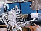 Lékai z Tince vyuívají pi operaci srdce i vylepenou virtuální realitu