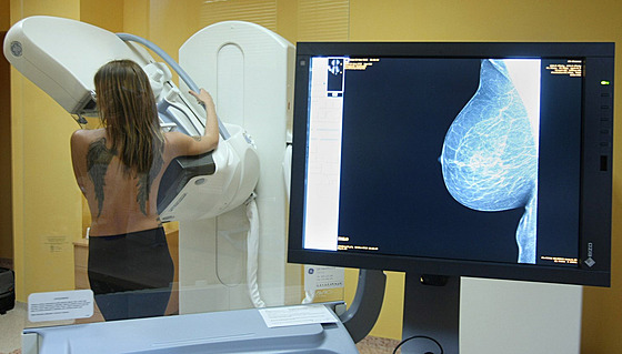 Mamografické vyetení v olomoucké nemocnici 