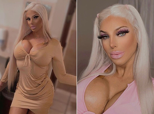 Ke vzhledu panenky Barbie si žena dopomohla plastikou, lidé ji obdivují