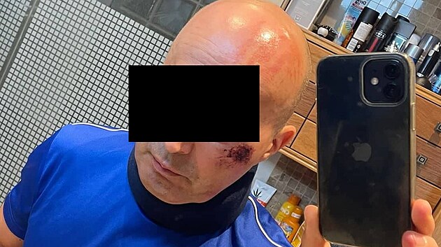 Cyklista utrpěl odřeniny na obličeji.