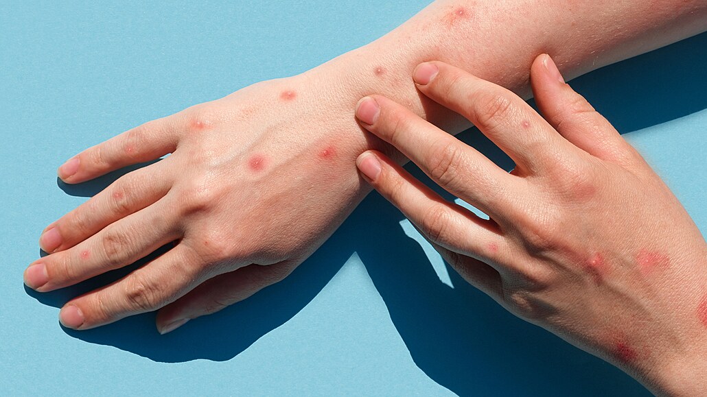 ilustra�ní snímek