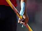 Oetená ruka Jiího Sýkory po zranní na mistrovství svta v Eugene.