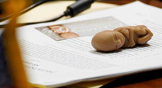 Indiana jako první stát v USA potraty (5. srpna 2022)