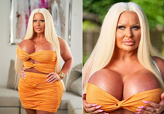 Chtěla vypadat jako Pamela Andersonová. Kromě velkým prsou ale podobnost s...