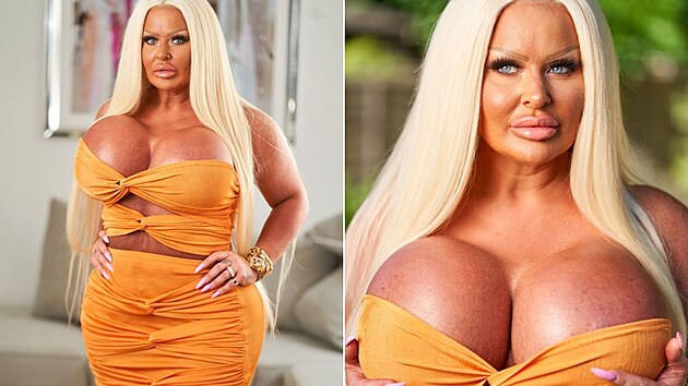 Chtěla vypadat jako Pamela Andersonová. Kromě velkým prsou ale podobnost s herečkou na první pohled není zřetelná.