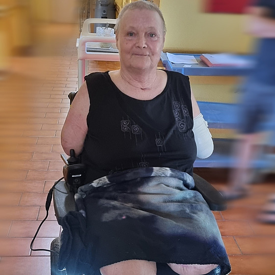 Eva poté, co jí léka�i kv�li covidu-19 amputovali v�echny kon�etiny