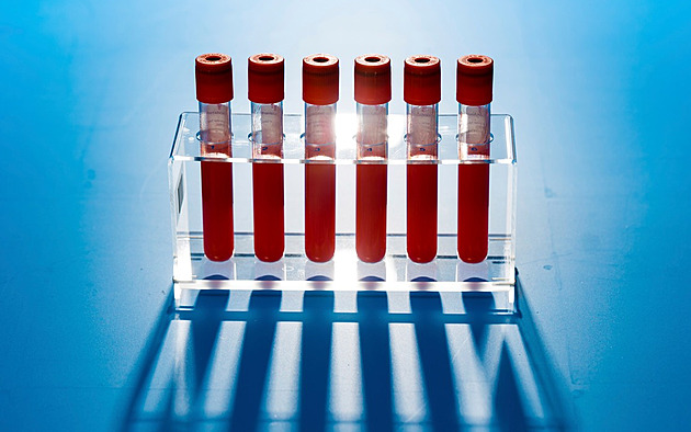Krevní testy vám mohou zachránit život. Na co si dát pozor při odběru?