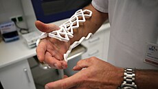 Fixaci tvo�í plastové sí�ované �tverce. Ty se rozeh�ejí ve speciální troub� a...