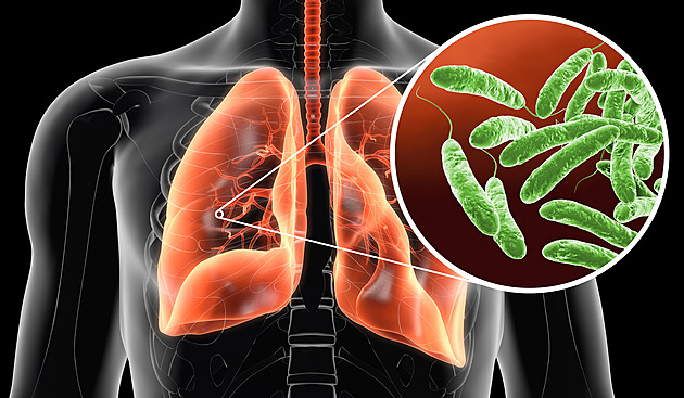 Šíří se smrtelná nemoc ze sprchy. Bakterii legionelle nahrává šetření za vodu